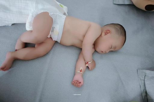 南城六个月宝宝眼睛散光